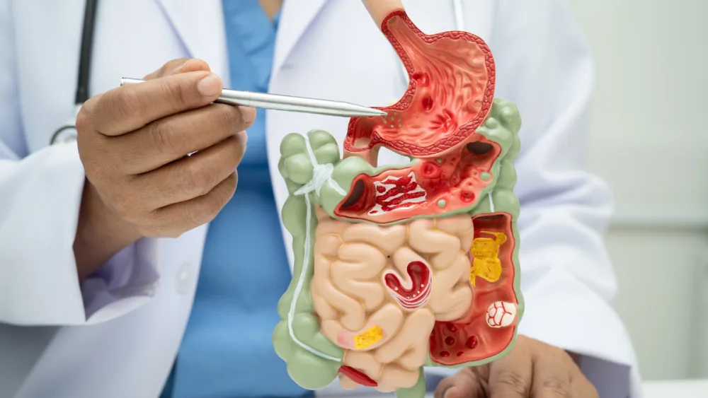 Surgical gastroenterology — GI tract anatomy, Dr. Babu Elangovan